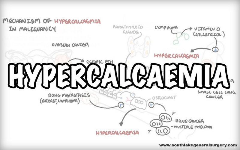 Hypercalcemia-surgery-southlake