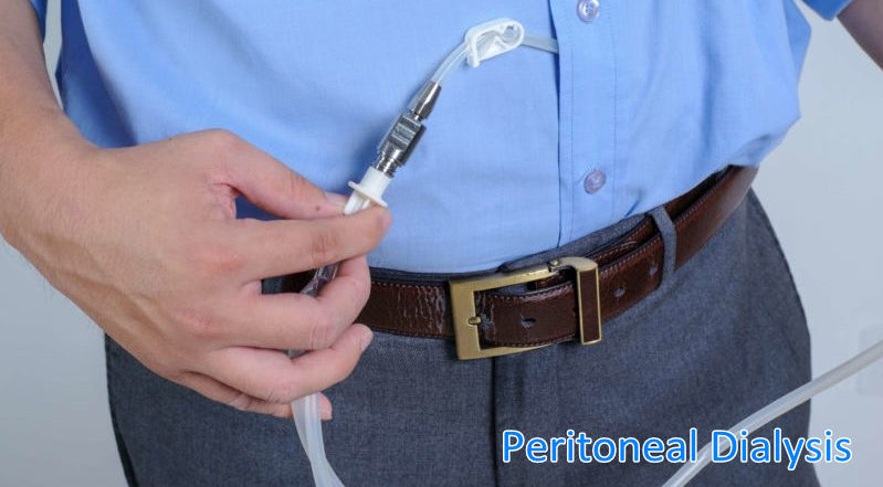 Peritoneal Dialysis