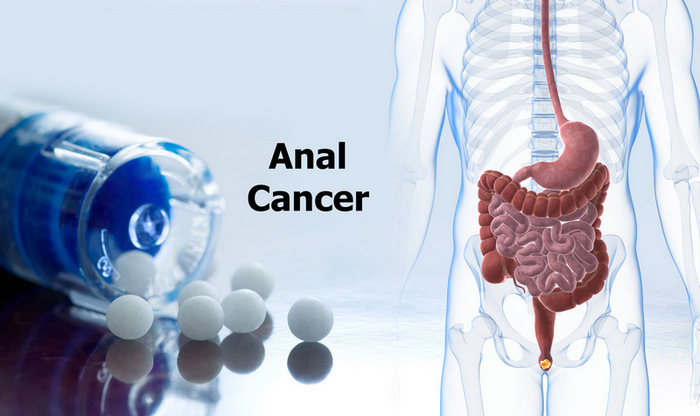 Anal treatment procedure