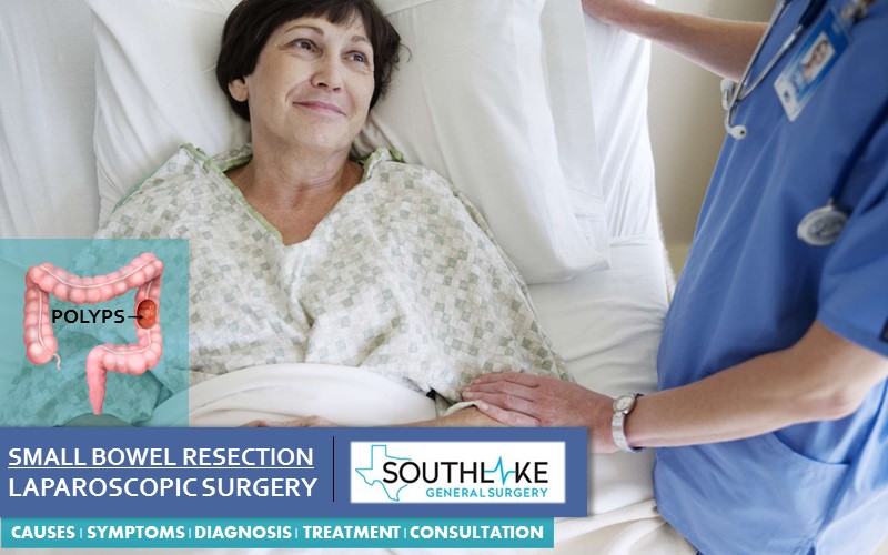 Small bowel Surgery Southlake