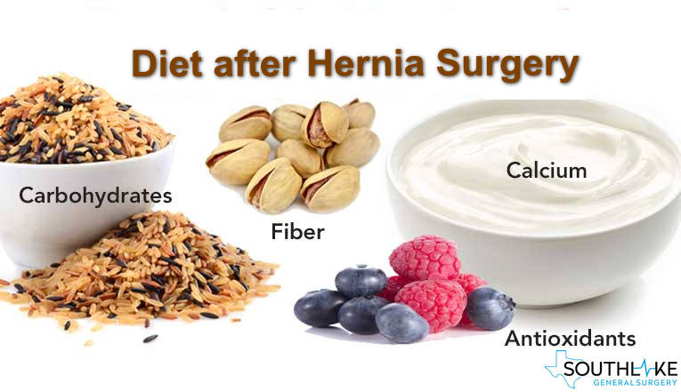 Diet after Hernia Surgery