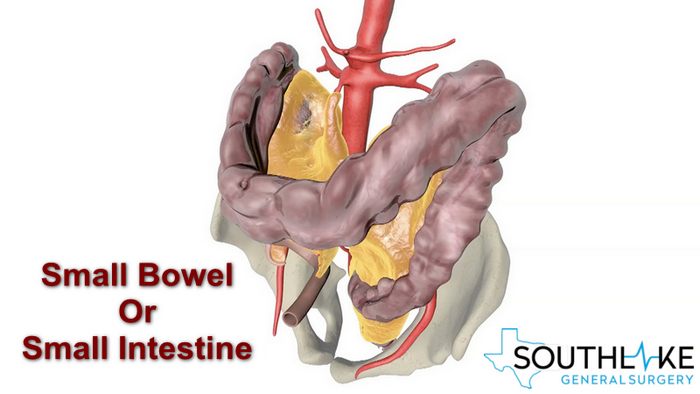 small_bowel_resection