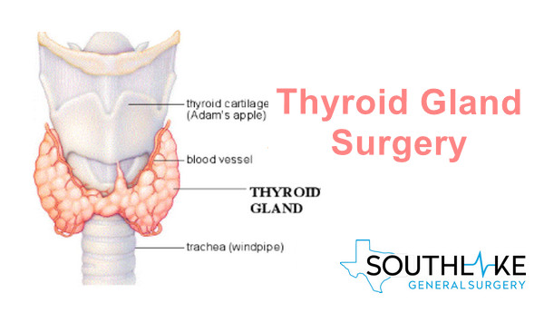 thyroid gland surgery southlake texas