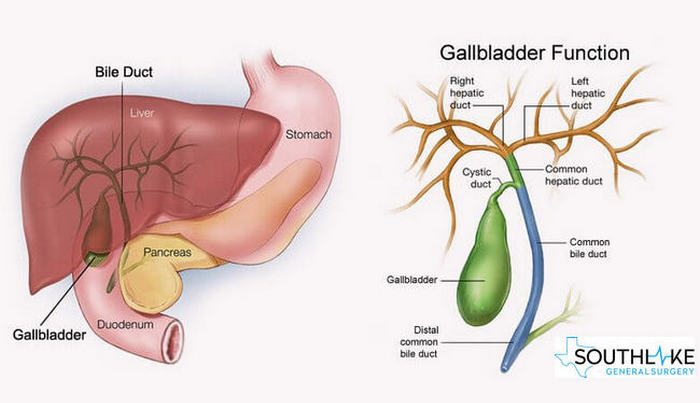 Gallbladder Surgery southlake texas