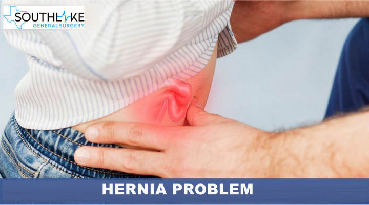 Hernia complications and prevention