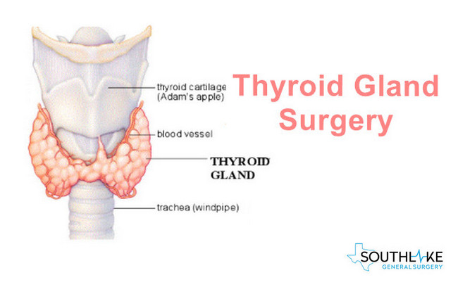 thyroid-gland-surgery