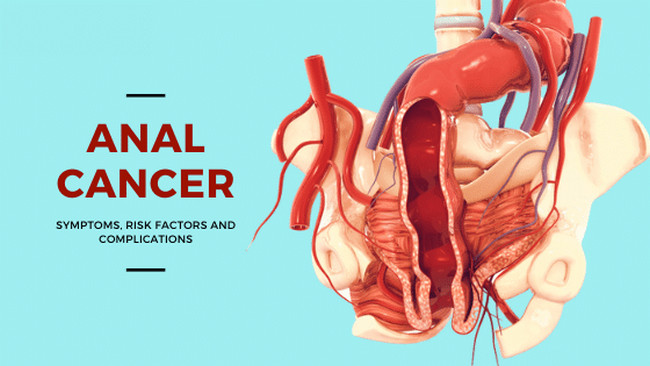 patients with peritoneal mesothelioma