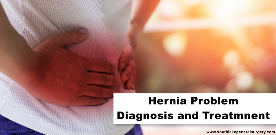 Hernia-problem-treatment-southlake