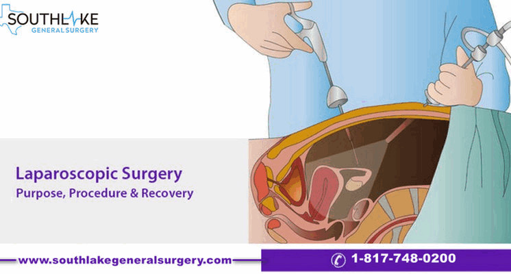 diagnostic-laparoscopy