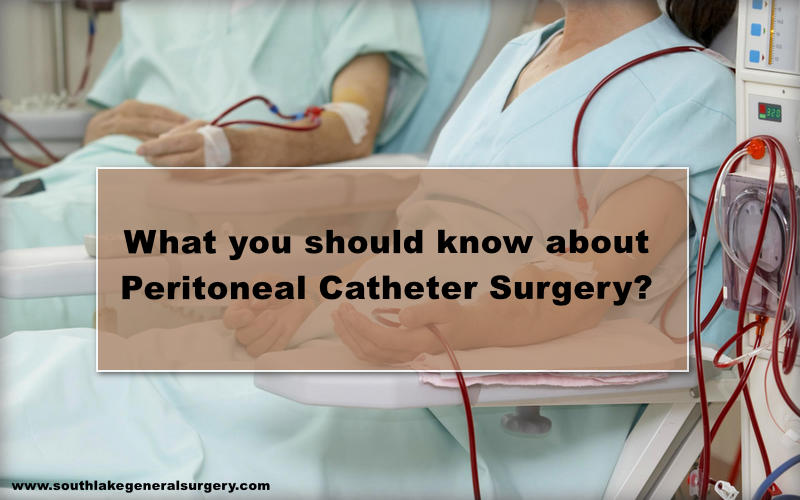 know-more-about-peritoneal-catheter-surgery