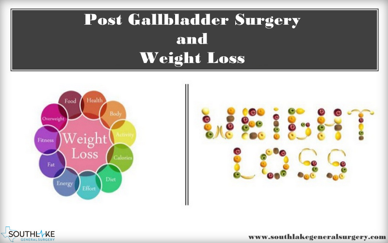 weight-loss-after-gallbladder-surgery