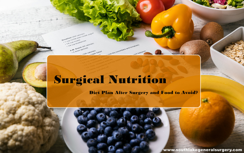Diet plan post surgery