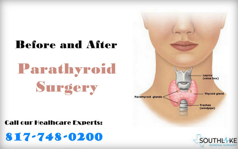 Before & After Parathyroid Surgery- Dr. Valeria Simone