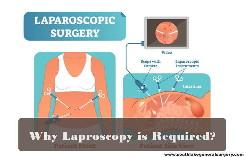 Best Laparoscopic Surgeon Southlake
