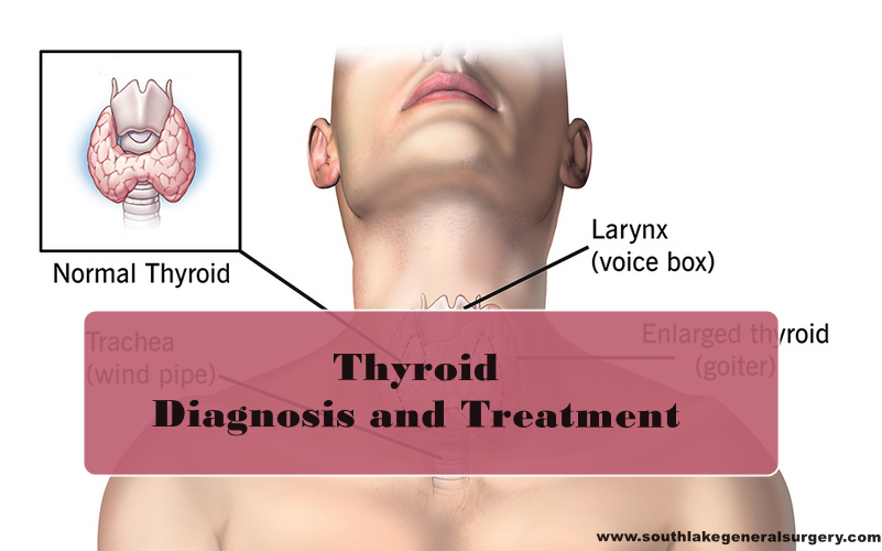 thyroid treatment southlake
