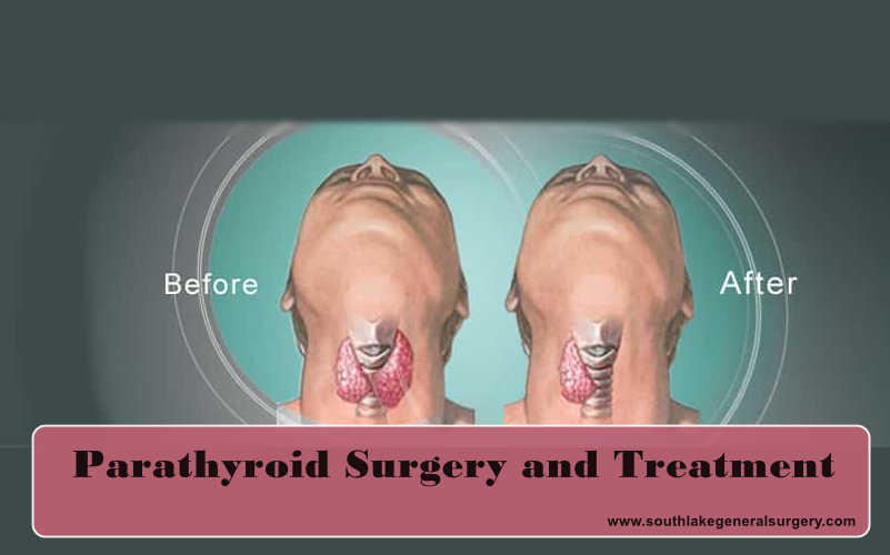 Parathyroid-Surgery-Southlake