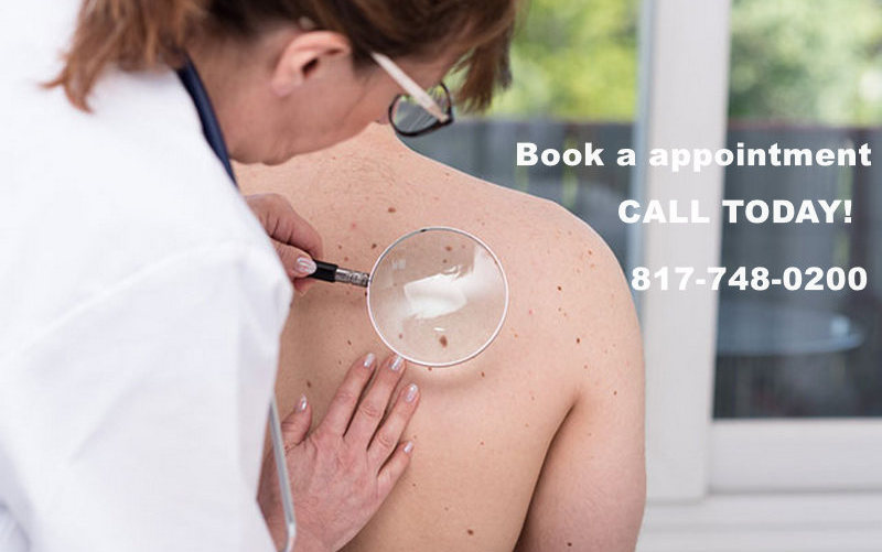skin infection treatment southlake