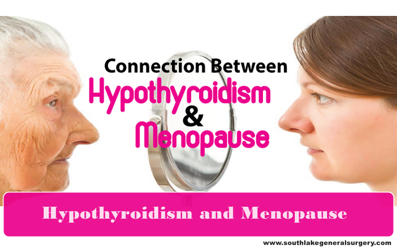 Hypothyroidism-And-Menopause