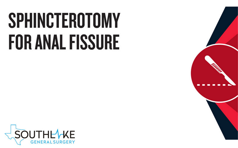 Sphincterotomy_for_Anal