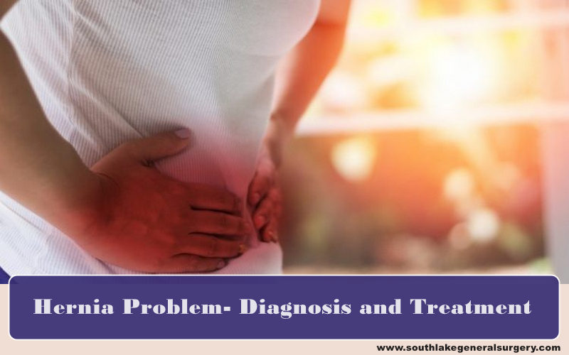 hernia-surgery-southlake-texas