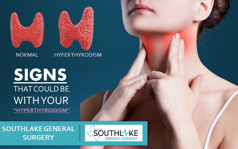 Hyperthyroidism symptoms