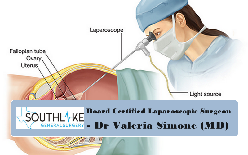 Board Certified General Surgeon- Dr Valeria Simone