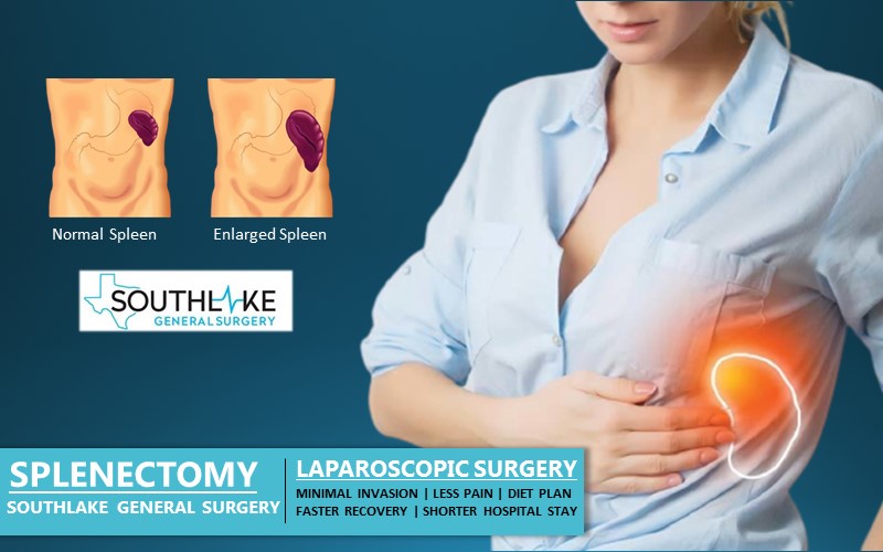 spleen surgery southlake