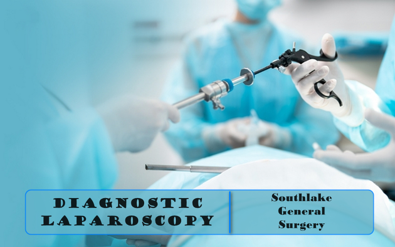 Diagnostic-Laparoscopy-Southlake