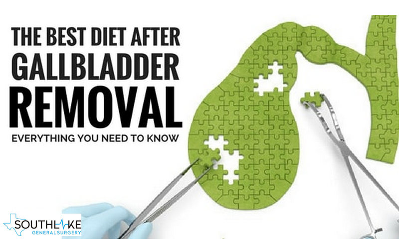 post gallbladder diet plan