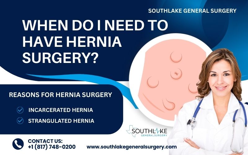 Illustration of a hernia in the abdominal wall showing a visible bulge, representing why hernia surgery may be needed.