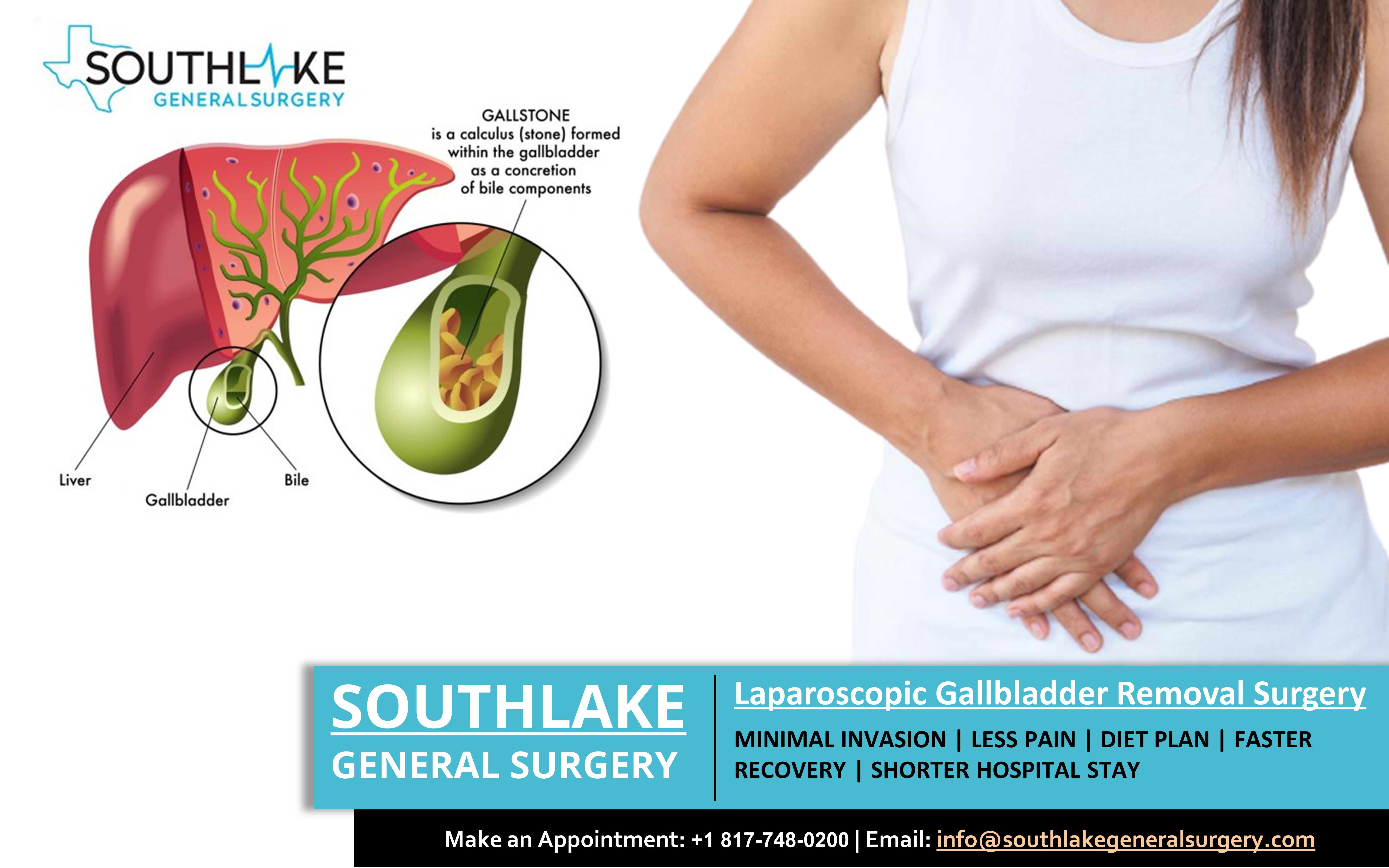 Gallstones Removal