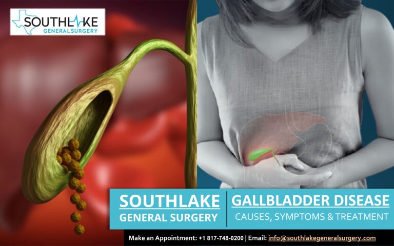 Gallbladder Disease – Dr. Simone MD - Southlake General Surgery