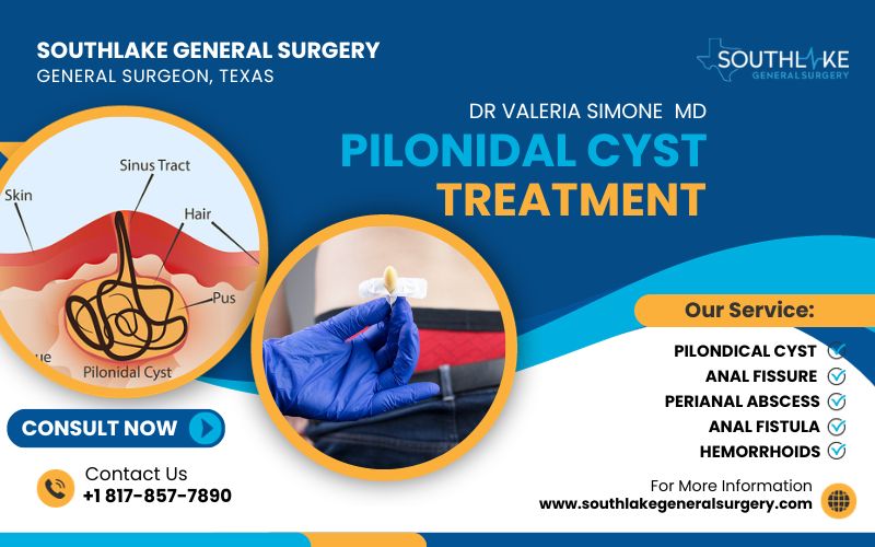 Pilonidal Cyst Treatment – Dr. Valeria Simone MD