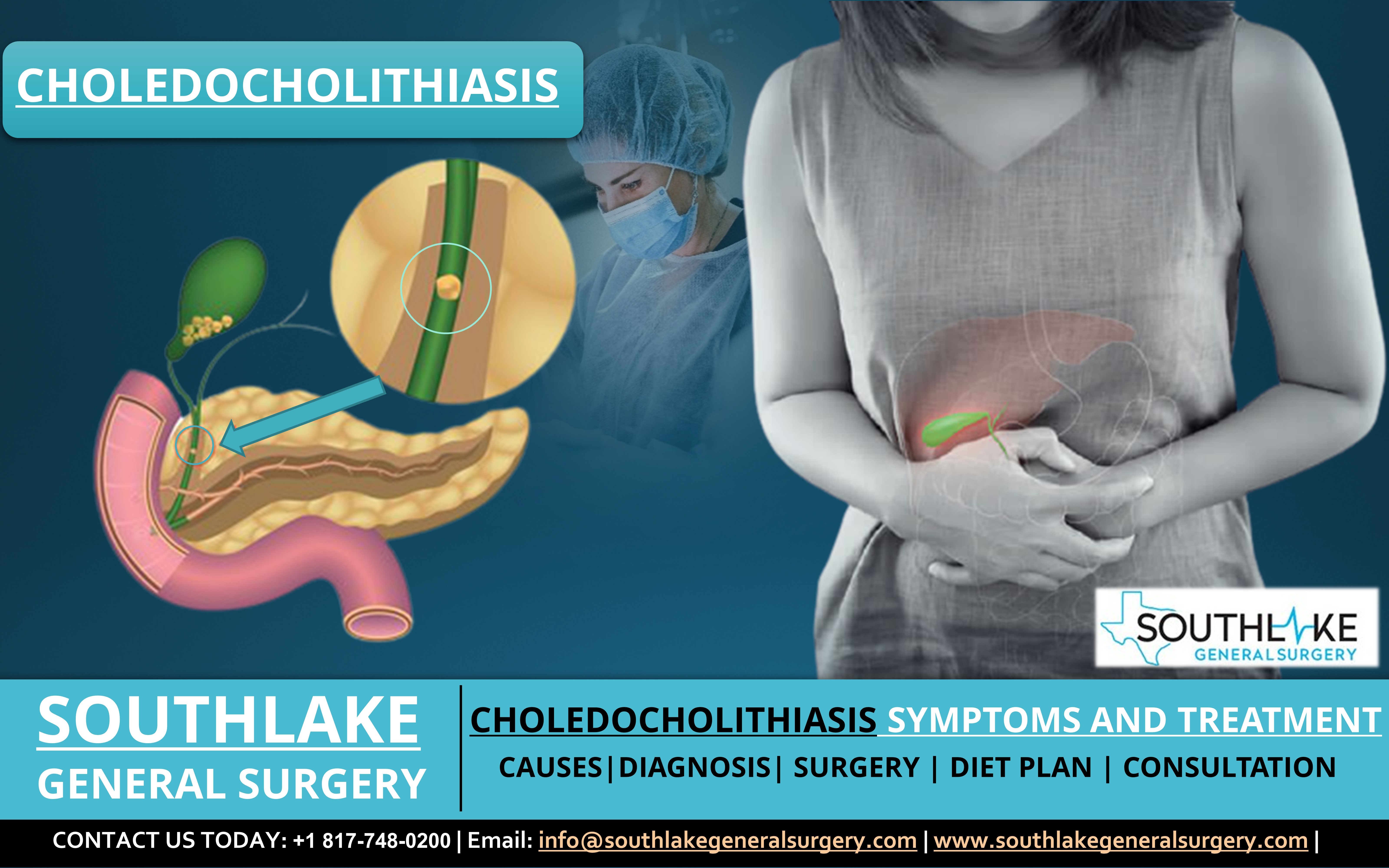 Choledocholithiasis Symptoms and Treatment