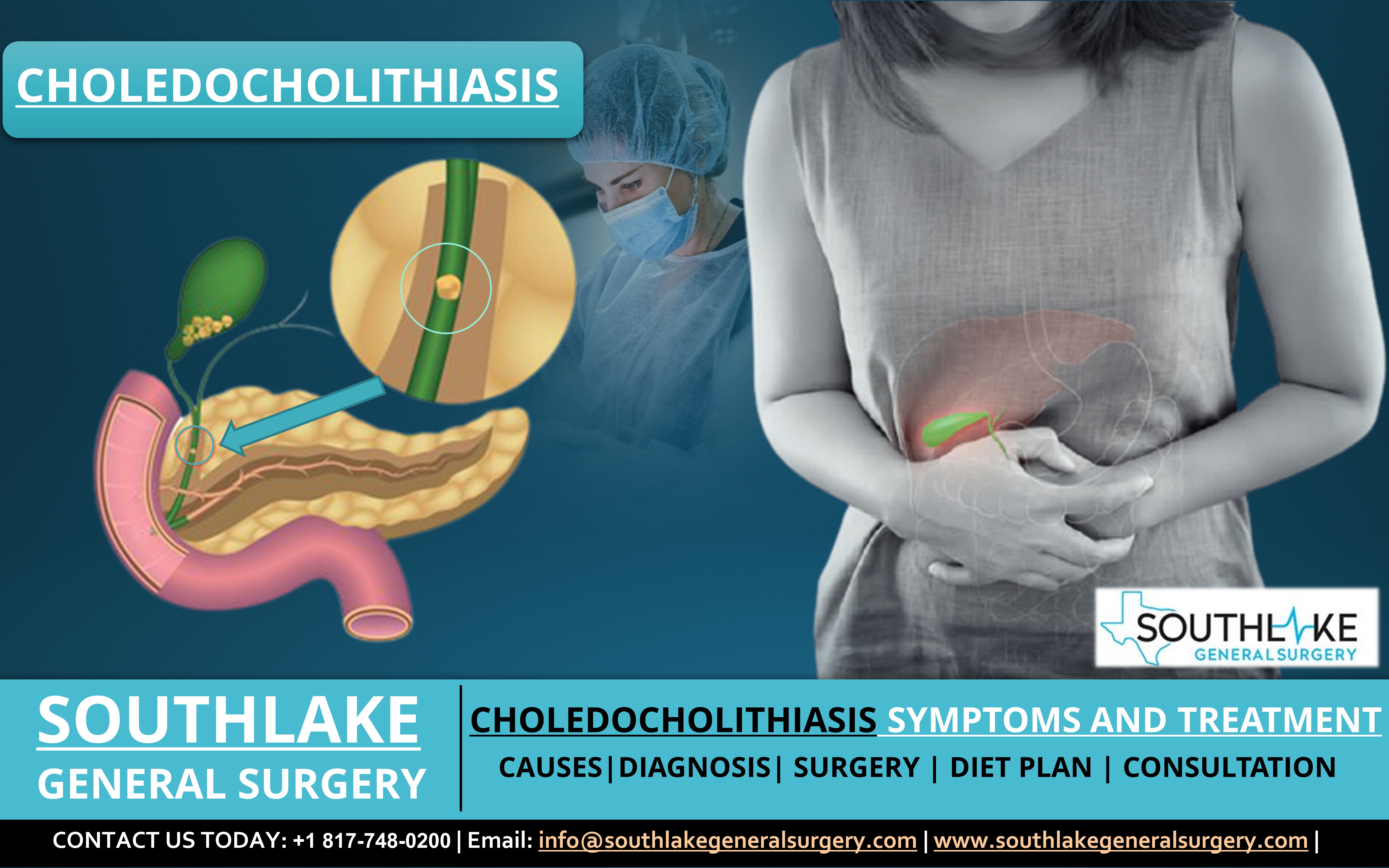 choledocholithiasis