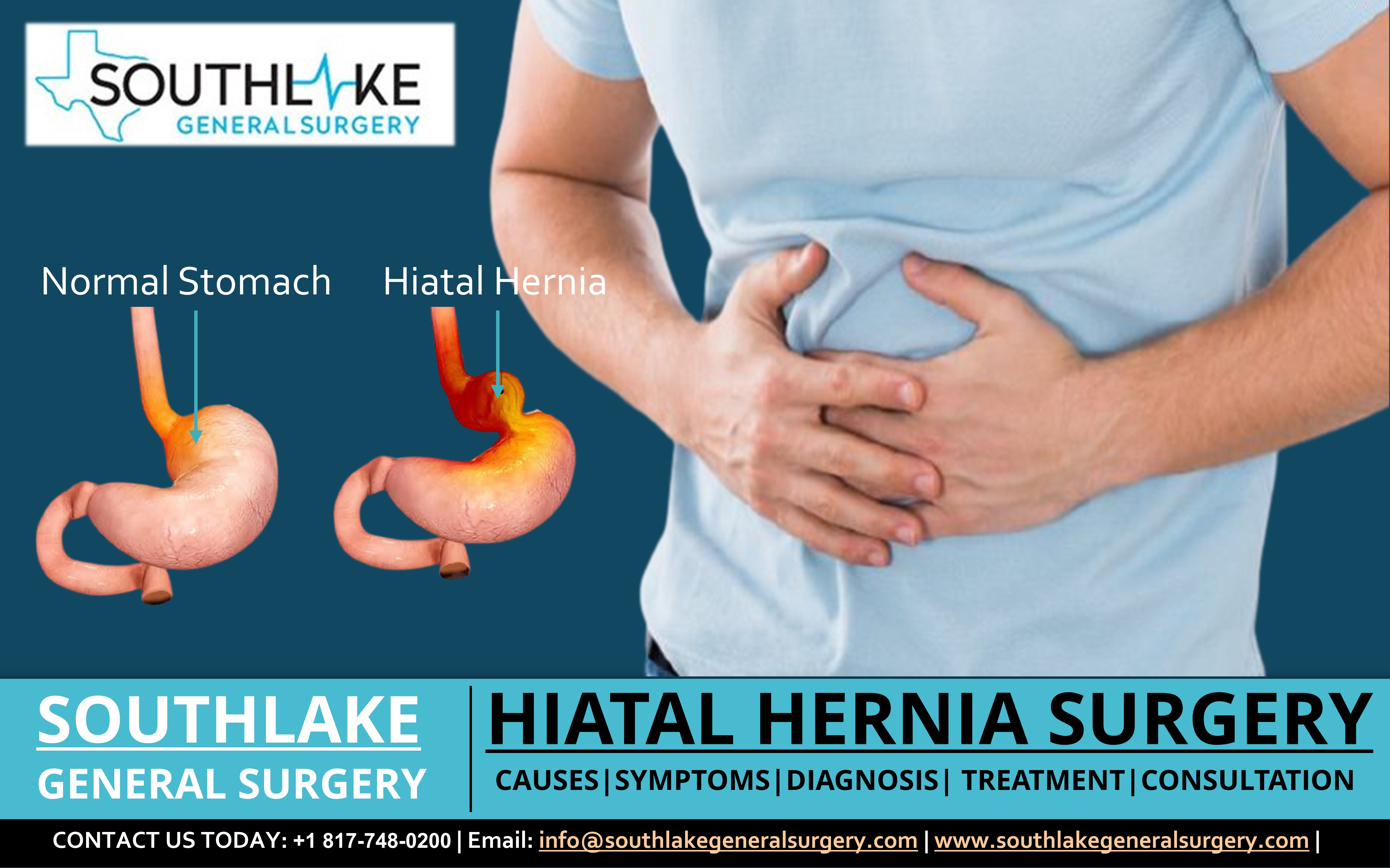 Hiatal Hernia Surgery at Southlake General Surgery, Texas