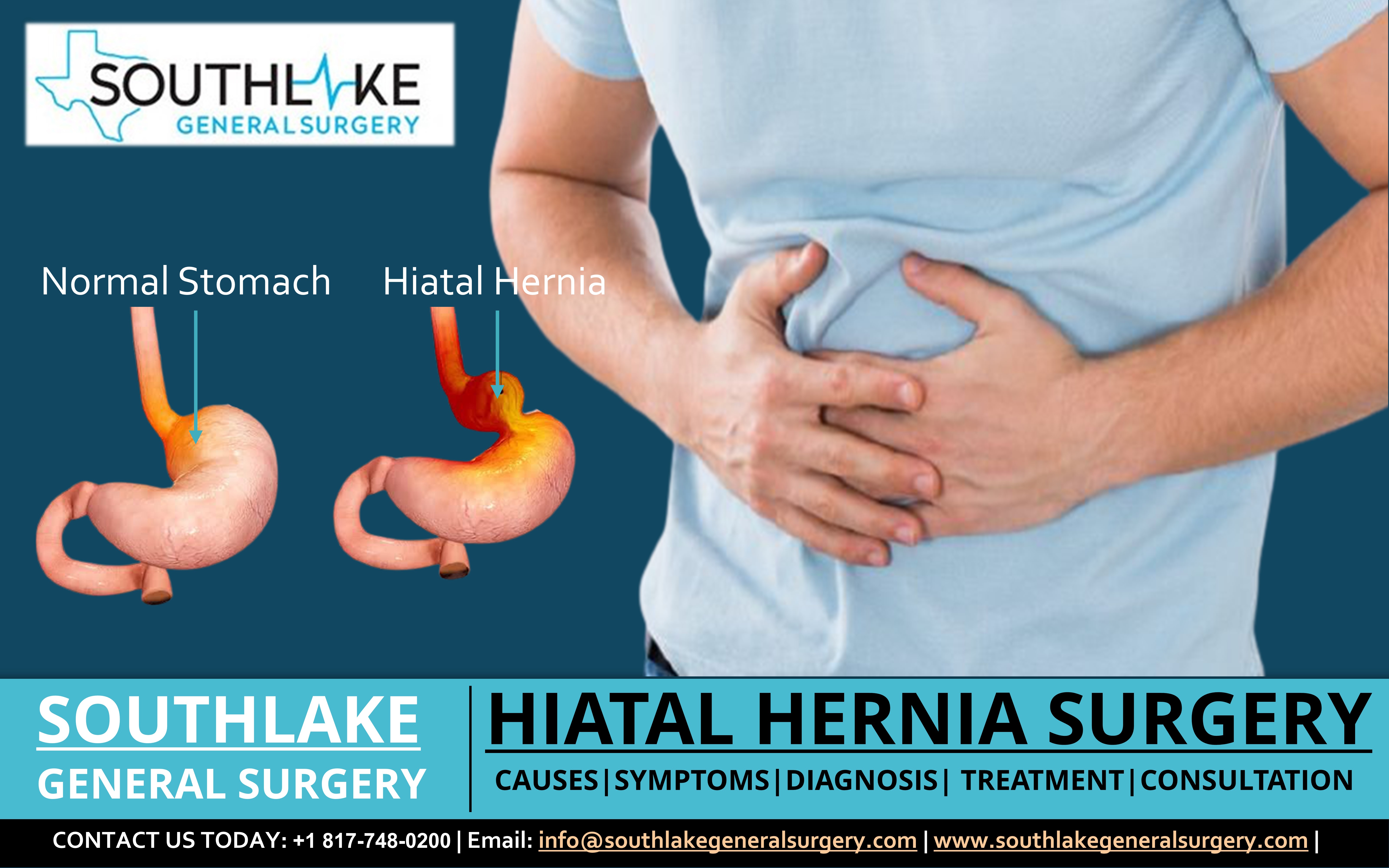 Hiatal Hernia