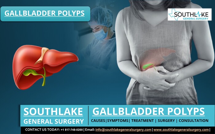 Gallbladder Polyps – Causes, Symptoms & Treatment - Southlake General ...