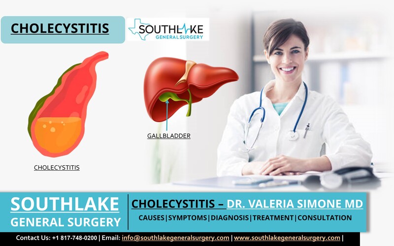 Cholecystitis - Causes, Symptoms, Treatment, and Surgery