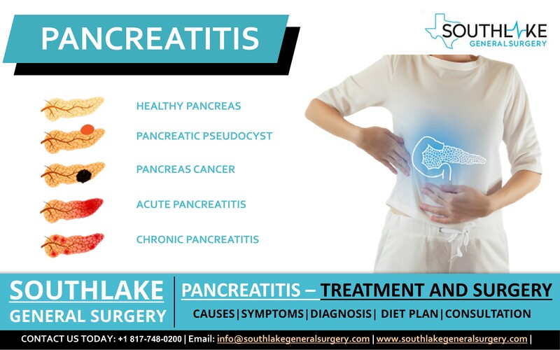 Pancreatitis Treatment and Surgery