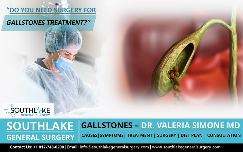 Do You Need Surgery for Gallstones Treatment