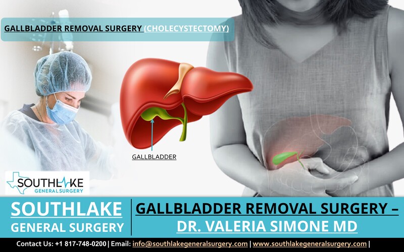 Gallbladder Removal Surgery (Cholecystectomy) – Dr. Valeria Simone MD