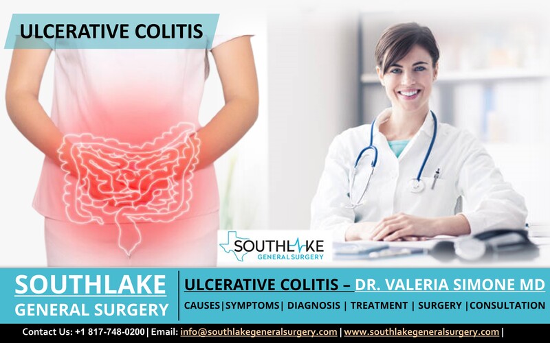 Ulcerative Colitis – Diagnosis, Treatment, and Surgery