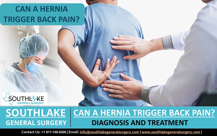 Can a Hernia Trigger Back Pain?