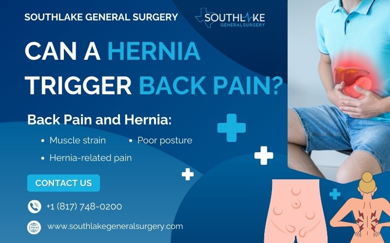 Medical illustration of an abdominal hernia bulging through the abdominal wall.