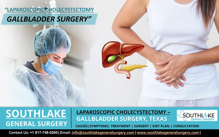 Laparoscopic Cholecystectomy - Gallbladder Surgery, Texas