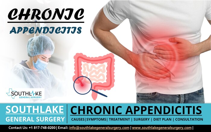 Chronic Appendicitis - Southlake General Surgery