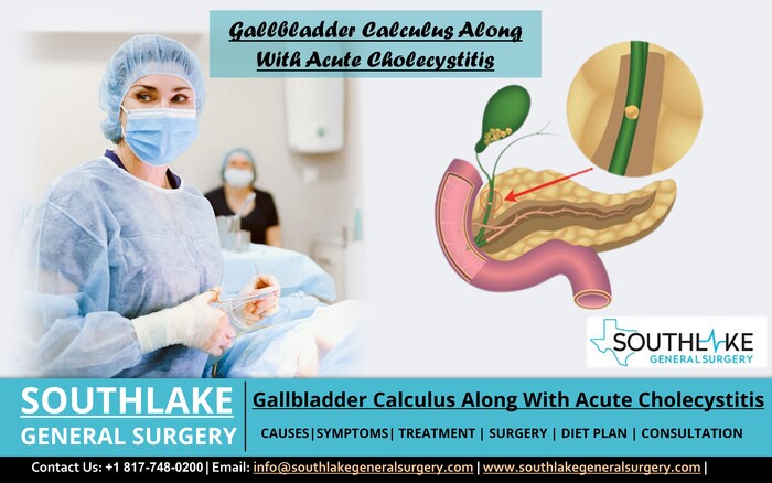 Gallbladder Calculus plus Acute Cholecystitis treatment