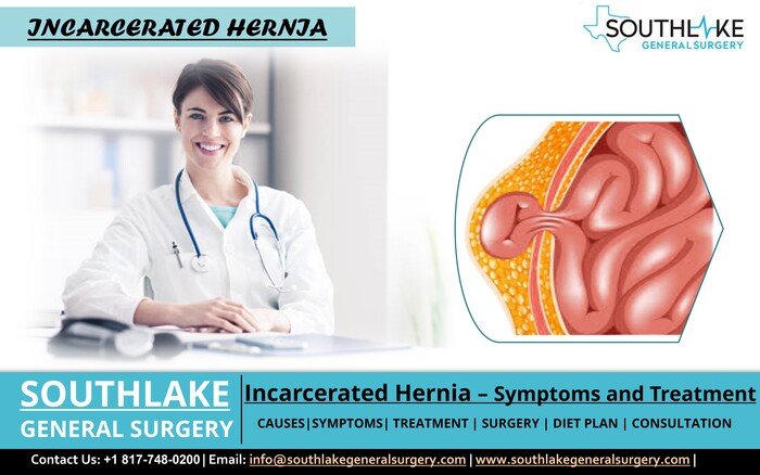 Incarcerated Hernia – Symptoms and Treatment
