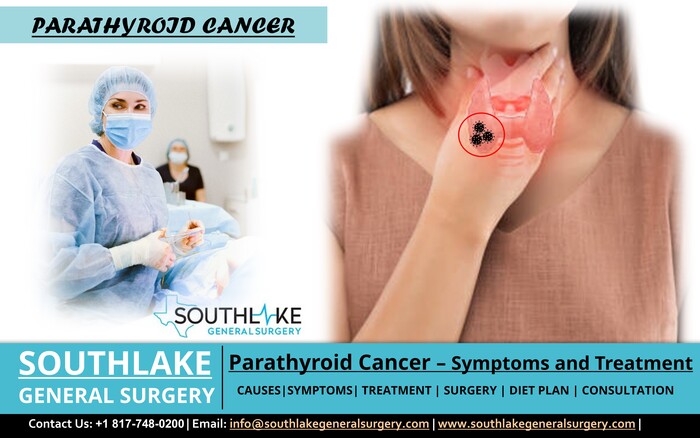 Parathyroid Cancer - Symptoms and Treatment